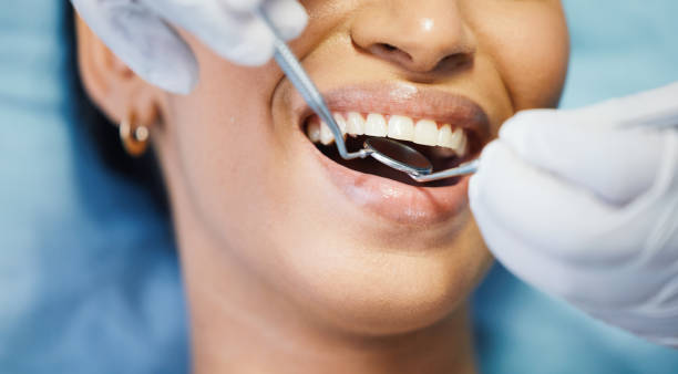 Best Knocked-Out Tooth Emergency  in Jarales, NM