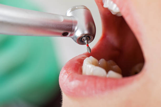 Best Tooth Infection Emergency Dentist  in Jarales, NM